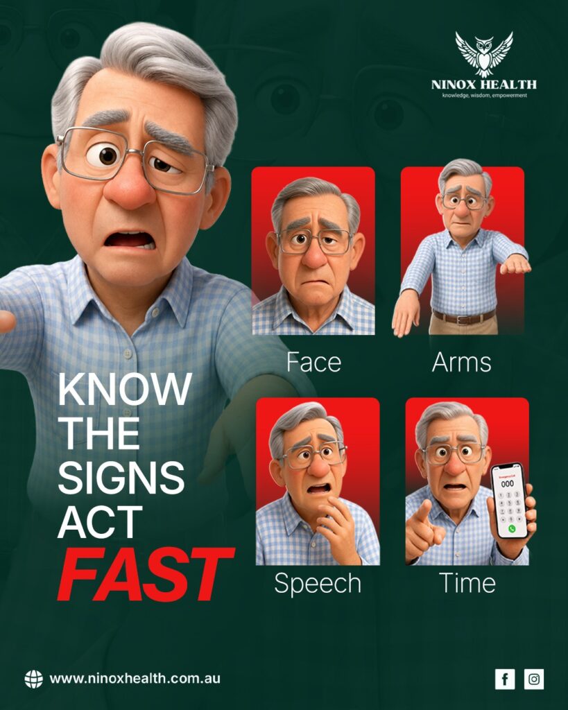 Know the signs of stroke - FAST